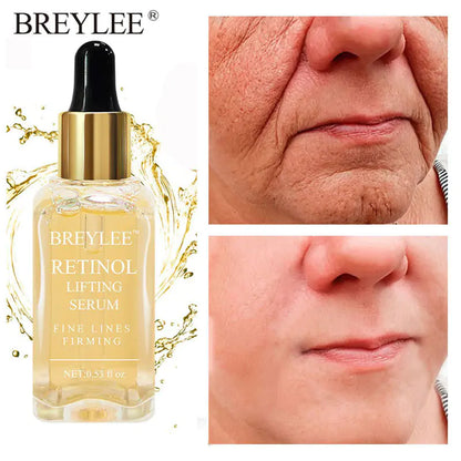 Breylee Retinol Anti-Aging Face Serum